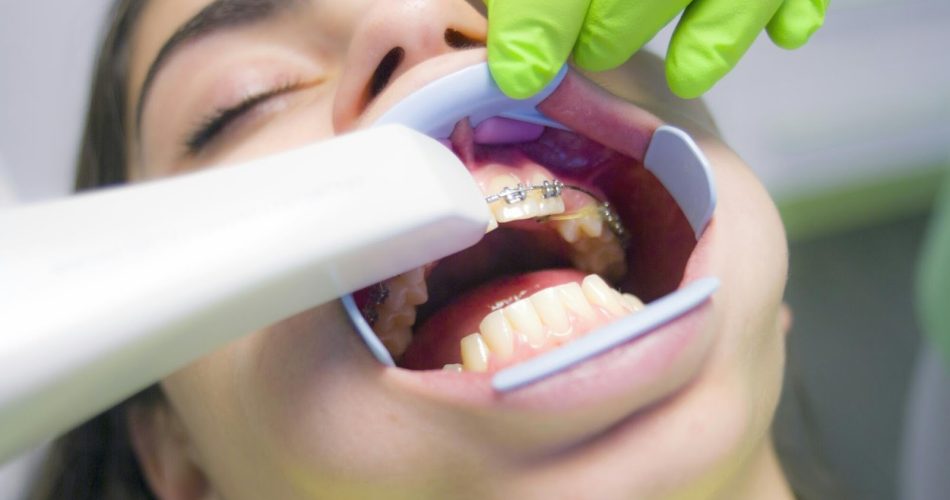 Oral Health and Confidence