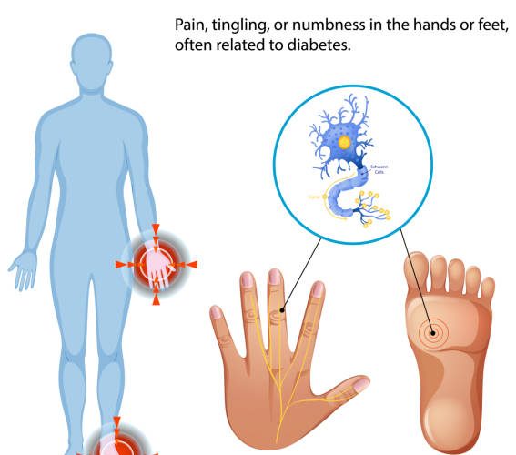 Causes of Peripheral Neuropathy